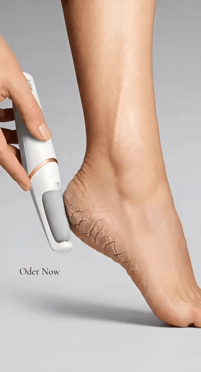 Râpe Électrique Anti-Callosités pour les Pieds